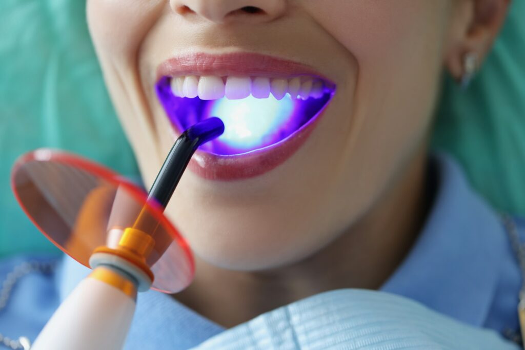 Professional Teeth Whitening